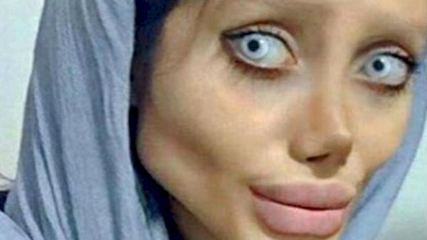 صور| سحر.. حاولت التشبه بانجلينا جولي وهذا ما حصل