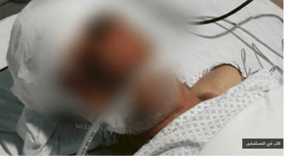 عندما يتحول الابن الى وحش بشري..محمد هشّم جمجمة والده من أجل 600 دولار!