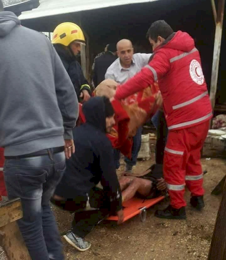 بالصور ..إصابة مواطنين بحروق