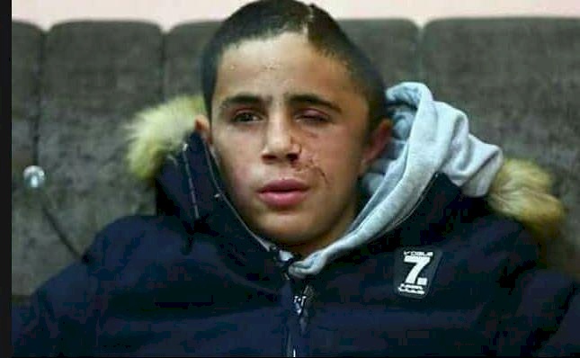 الاحتلال يحارب عائلة التميمي