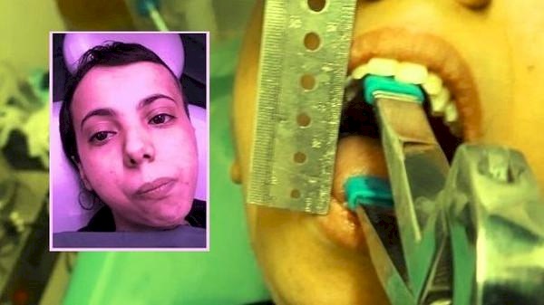 تعرف على المرض الذي منع فاطمة اليمنية من فتح فمها طوال 30 سنة