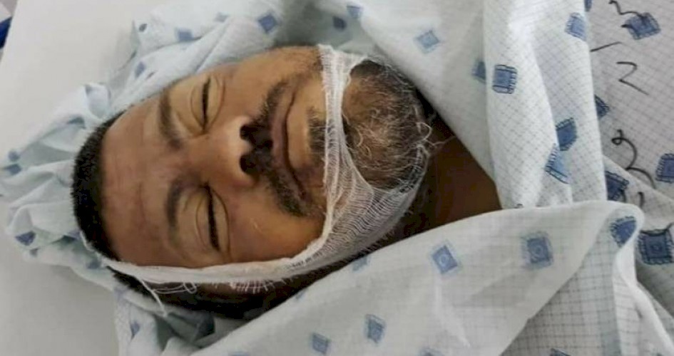 مسيرة العودة..الشهيد الـ 30 يرتقي متأثراً بجراحه