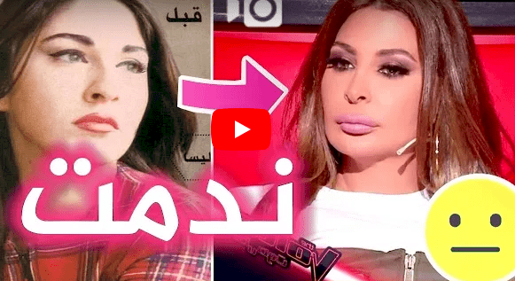 فيديو/ اليسا تندم من عمليات التجميل ! 