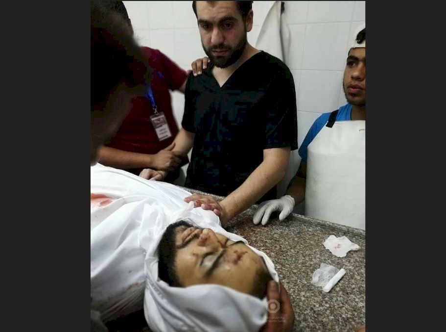 صورة القهر في غزة.. حينما يفاجأ الطبيب بجثة أخيه