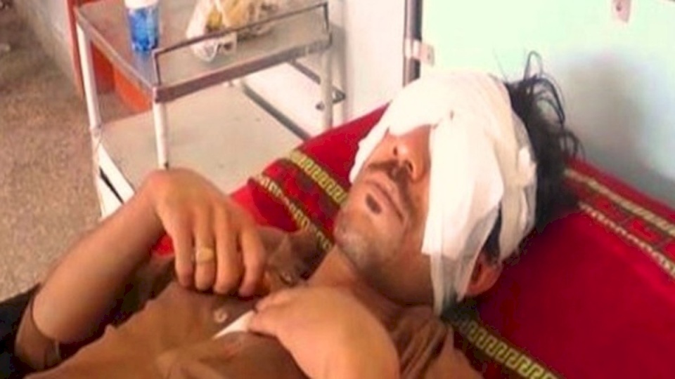 أراد الزواج على مزاجه فهاجمه أبوه وإخوته واقتلعوا عينيه