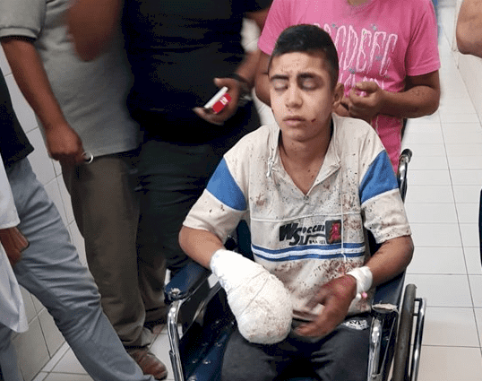 اصابة فتى بانفجار جسم مشبوه في الخليل