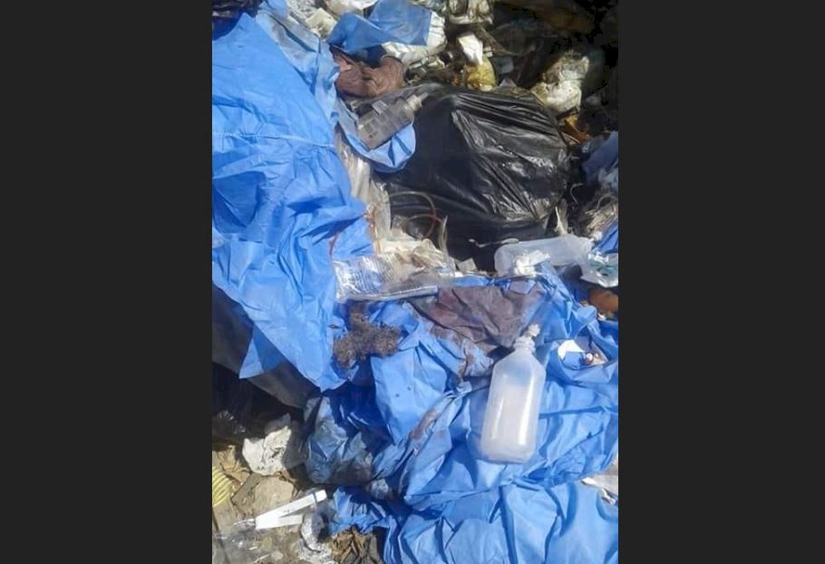 كبد وأعضاء بشرية في قمامة بمصر.. رعب وتحقيق