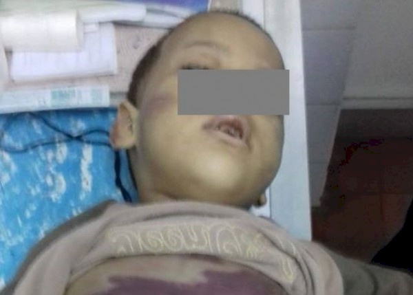 مصرية تعذب طفلها بعد أن شاهد شقيقته في أوضاع مخلة