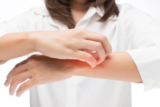 علاجات الجدات لـ لدغات الحشرات