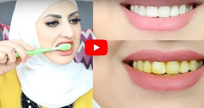 فيديو/ خلطة لتبييض الاسنان من أول استخدام