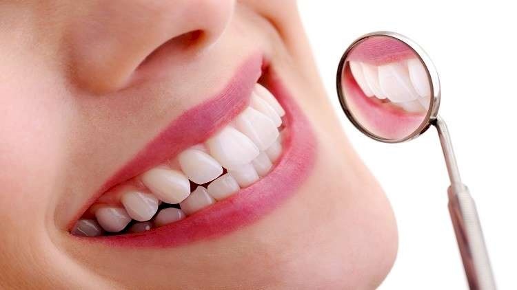اكتشاف الطريقة "الأكثر أمانا" لتبييض الأسنان!