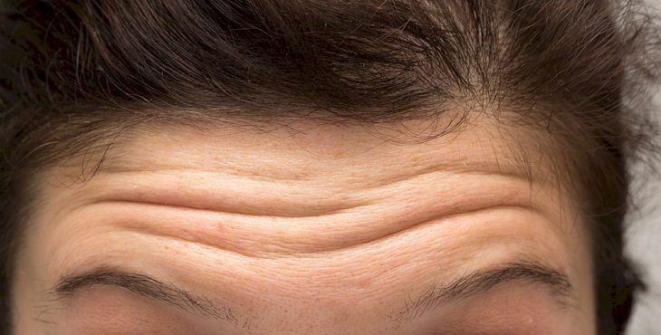 تجاعيد الجبين العميقة تشير إلى مشكلة صحية خطيرة