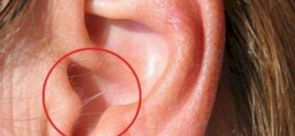 هام جداً.. هل لديك شعر على أذنك؟
