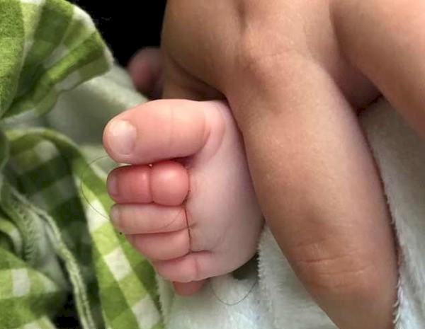 خصلة شعرها كادت أن تتسبب ببتر أصابع رضيعها