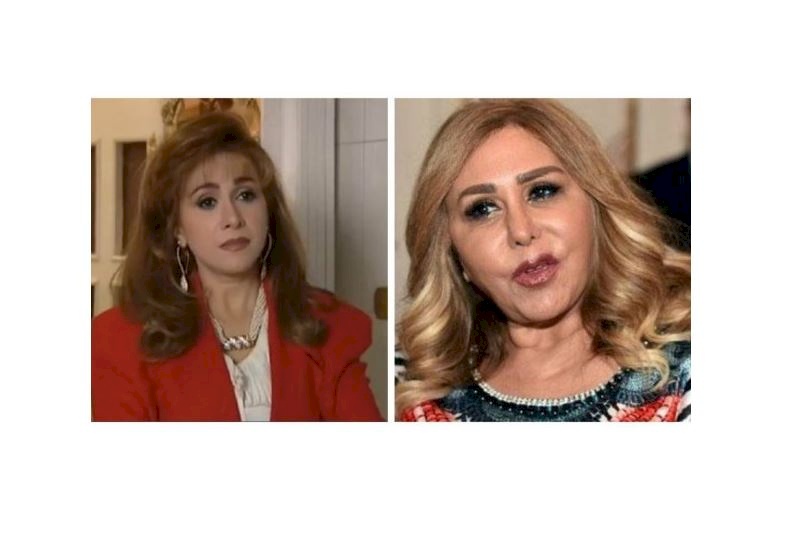 صورة : بعد التشوه والعلاج... مها المصري تتعرض لانتكاسة تجميلية جديدة