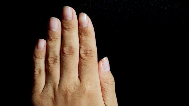 تطبيق يعتمد صور الأظافر للكشف عن الإصابة بفقر الدم