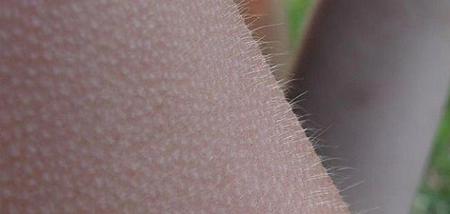 لماذا يشعر البشر بالقشعريرة؟