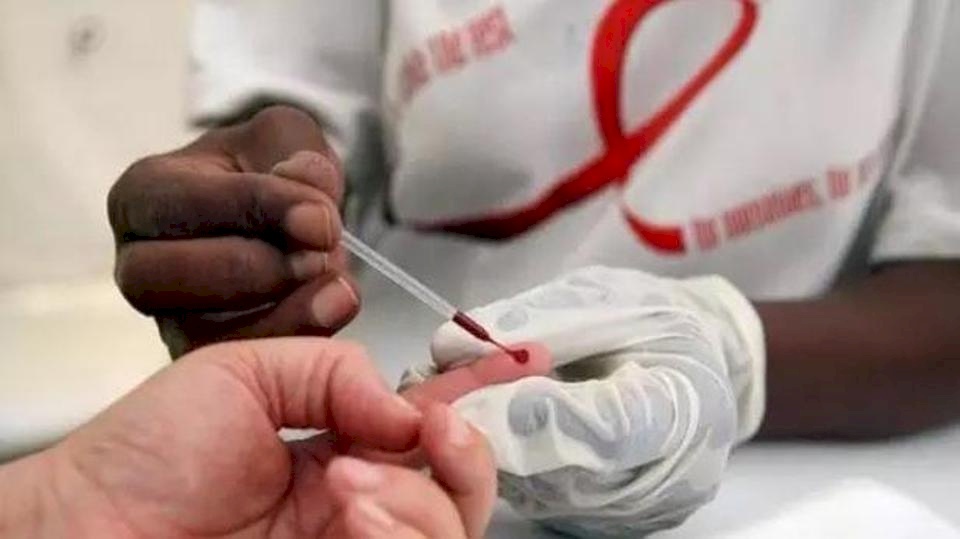 التوصل إلى طريقة للتخلص من خلايا مخزّنة لفيروس الإيدز