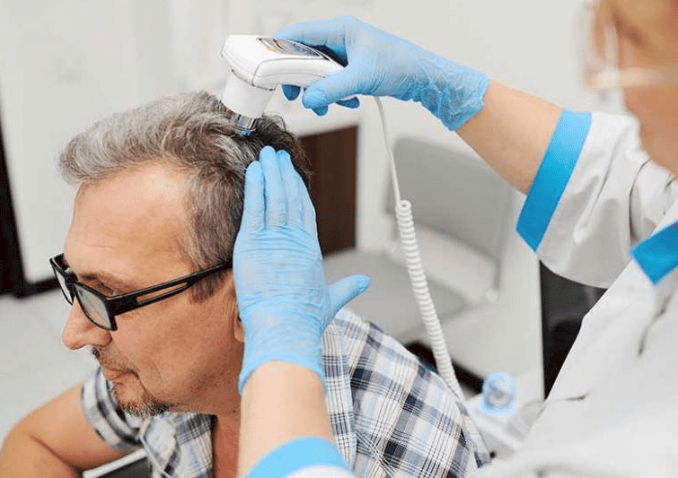 معلومات مهمة عن عملية زراعة الشعر