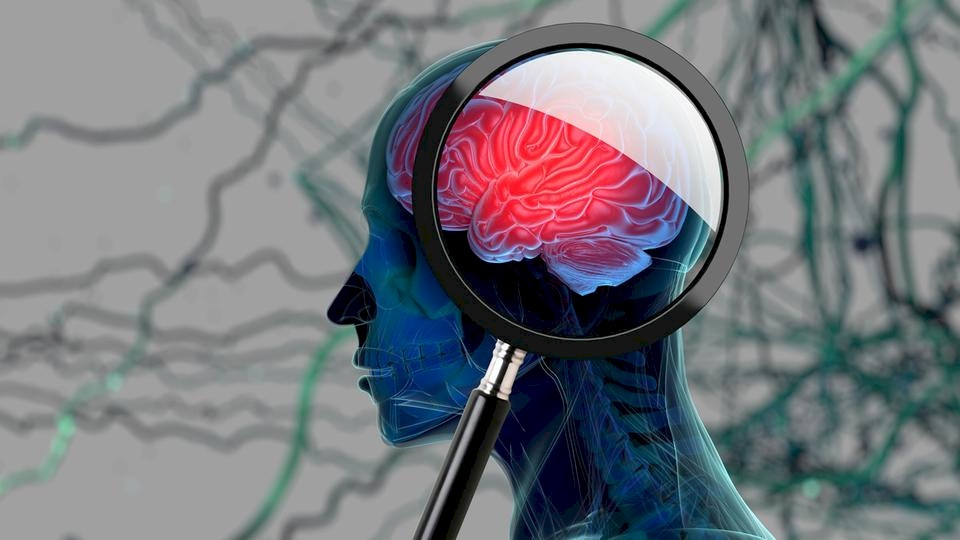 النسيان دليل على الذكاء وليس الغباء