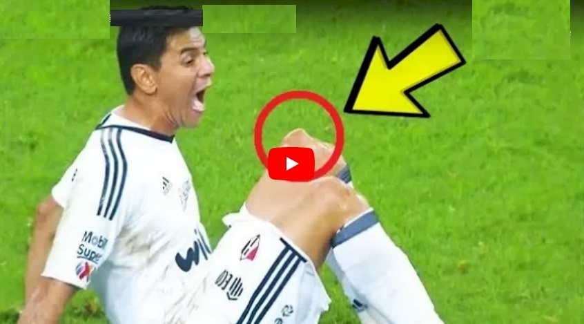 فيديو.. أسوء 10 إصابات في تاريخ كرة القدم