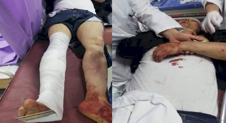 صور.. يعاني جروحاً خطيرة.. هكذا اعتدت حماس على عاطف ابو سيف