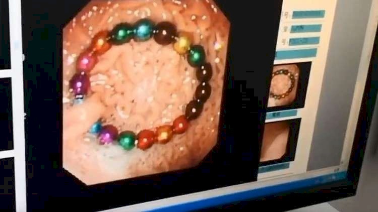 بالفيديو..طفلة "تجمع" في أحشائها سوارا عجيبا وتعرض نفسها للخطر 