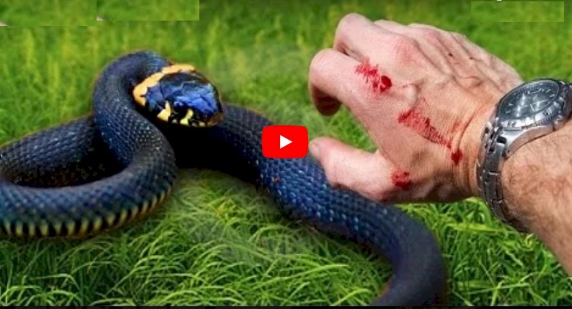 فيديو.. الدفاع المدني: ارشادات هامة للتعامل مع لدغة الافاعي
