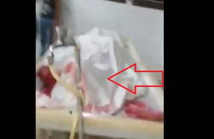 سرقة أعضاء ميت من مشفى عربي