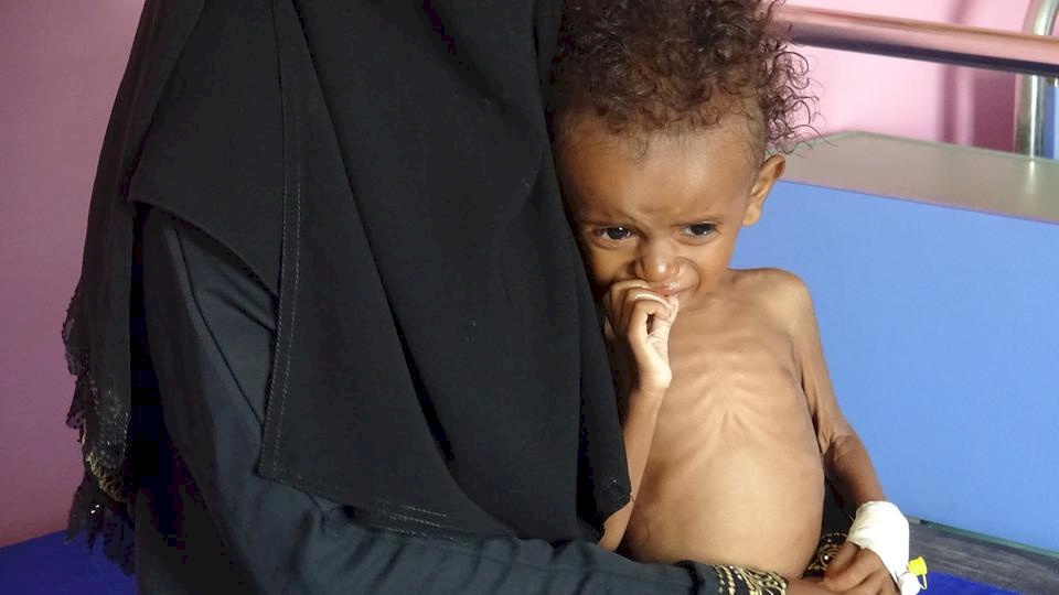 50 مليون شخص في المنطقة يعانون من "نقص التغذية"