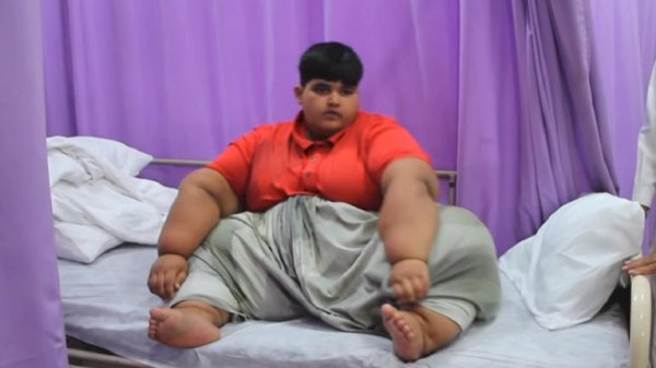 طبيب يتعهد بعلاج الطفل الأكثر بدانة في العالم بعد محاولات بائسة عديدة