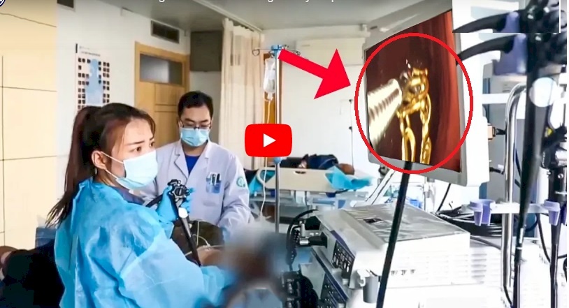 فيديو.. فتاة تبتلع ذهبها لهذا السبب ! 