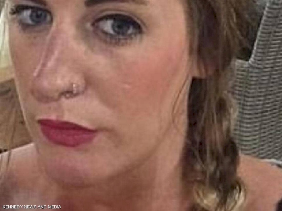 بالصور.. ذهبت لنفخ شفاها وهذا ما حدث