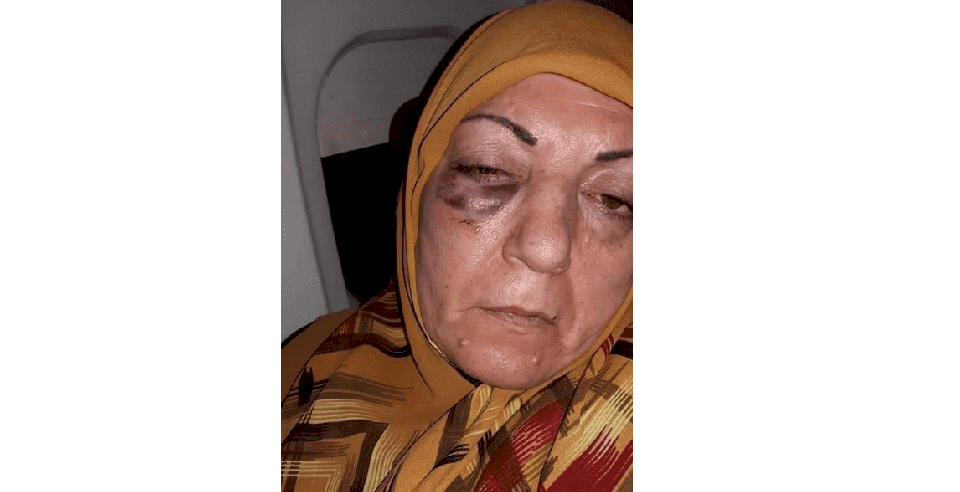 صورة السيدة العراقية المضروبة في إيران تثير غضب العراقيين