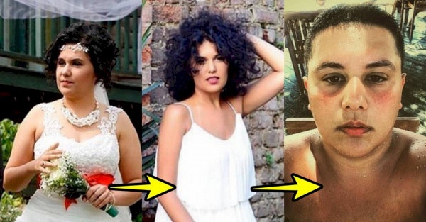 ممثلة تركية تخضع لعملية تحويل جنس