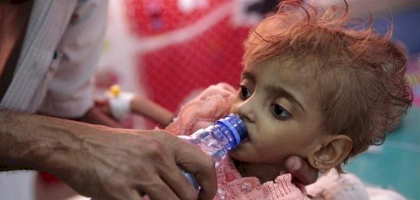 في اليمن.. وفاة 257 يمنيا بوباء الدفتيريا