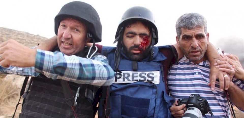 نقابة الصحفيين تستنكر اعتداء الاحتلال على المصور عمارنة 