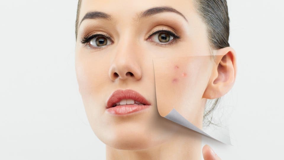 أطعمة قد تتسبب بظهور البثور على البشرة