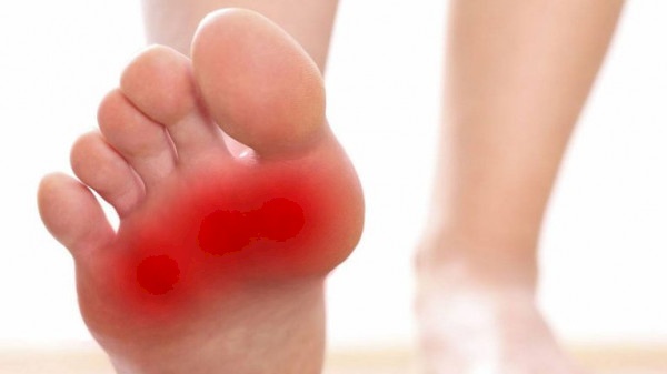 علاجات منزلية للتخلص من مشكلة حرقة الأقدام