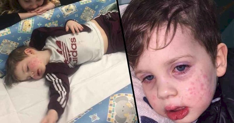 بسبب قبلة.. رضيع سيعاني من "فيروس هربس" مدى الحياة