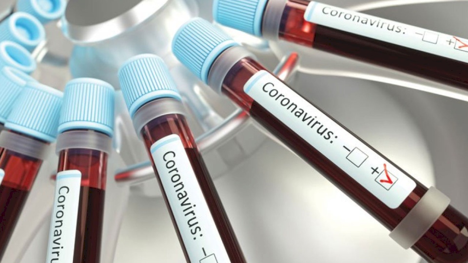 ارتفاع حصيلة إصابات كورونا في الأردن إلى 112