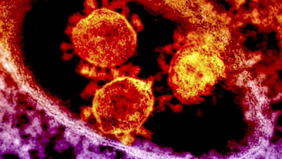 هل يظل فيروس كورونا في جسم المصاب لسنوات؟