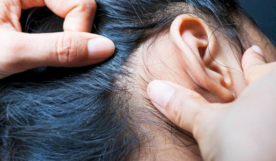مفاجأة .. علاج "لقمل الرأس" يمكنه قتل كورونا خلال 48 ساعة!