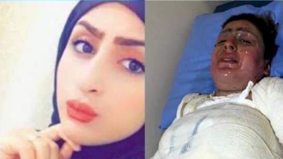 جديد قصة ملاك التي أحرقت نفسها وأبكت الجميع