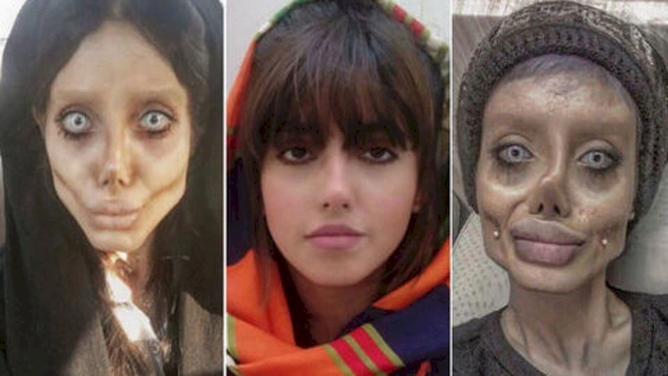 "أنجلينا جولي إيران" من الحجر للمستشفى.. كورونا فتك برئتيها