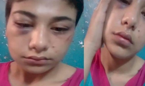 في مصر: اغتصبوها وضربوها وصوّروها.. طالبت بحقها ثمّ "تنازلت"