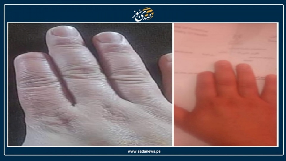 زوجها قطع إصبعها.. "رماح" فلسطينية تروي قصة التعذيب التي تعرضت له بالمطرقة والسكين!