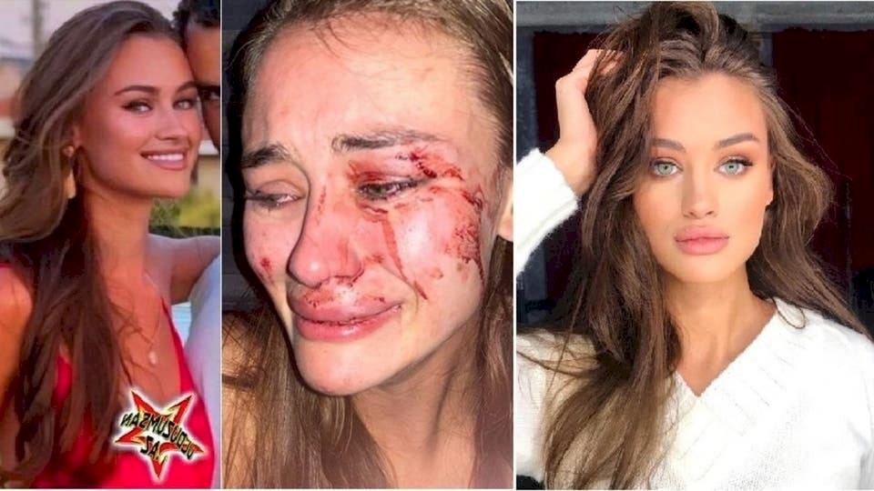 هكذا انتهت الحال بعارضة أزياء وهي تمضي عطلتها بتركيا