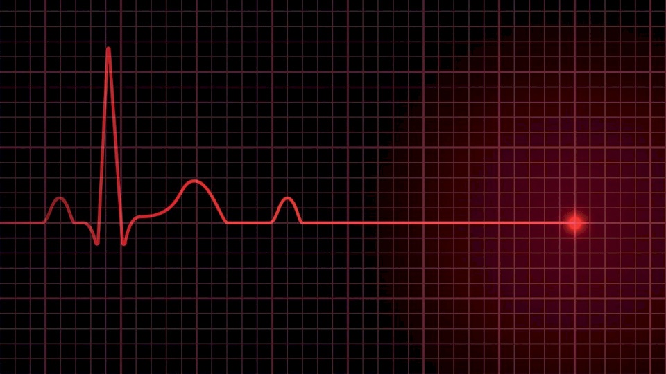 توقف قلبها عن النبض 127 مرة خلال ساعات وعادت للحياة