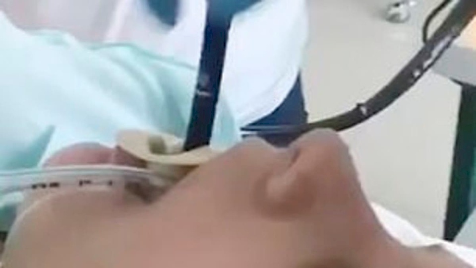 احذر فيديو صادم.. إخراج ثعبان من فم امرأة روسية